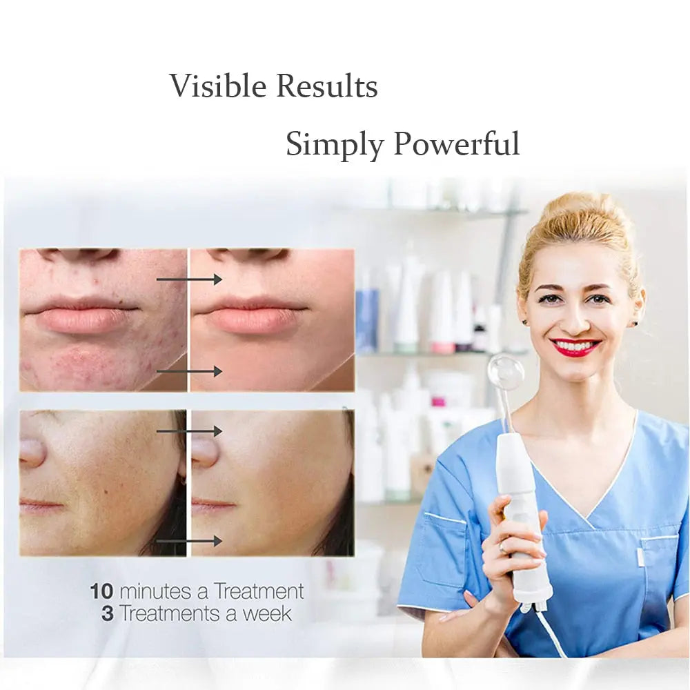 Beauty Star 7In1 High Frequency Facial Machine Electrode Glass Tube Wand Spot Streetsharks