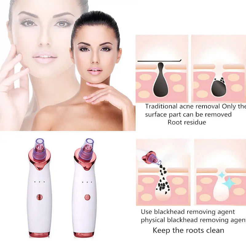 Blackhead Remover  Acne Vacuum Suction Face Clean Black Head Pore Cleaning Beauty Skin Care Tool StreetSharks