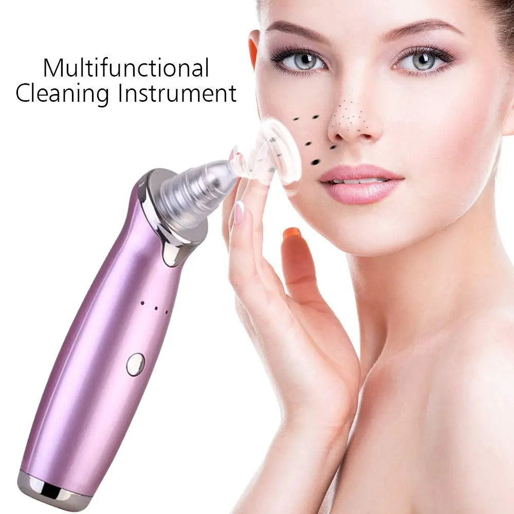 Electric Blackhead Remover Pore Vacuum Suction Diamond Dermabrasion Face Cleaner StreetSharks