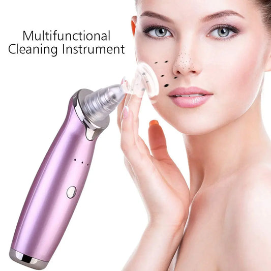 Electric Blackhead Remover Pore Vacuum Suction Diamond Dermabrasion Face Cleaner StreetSharks