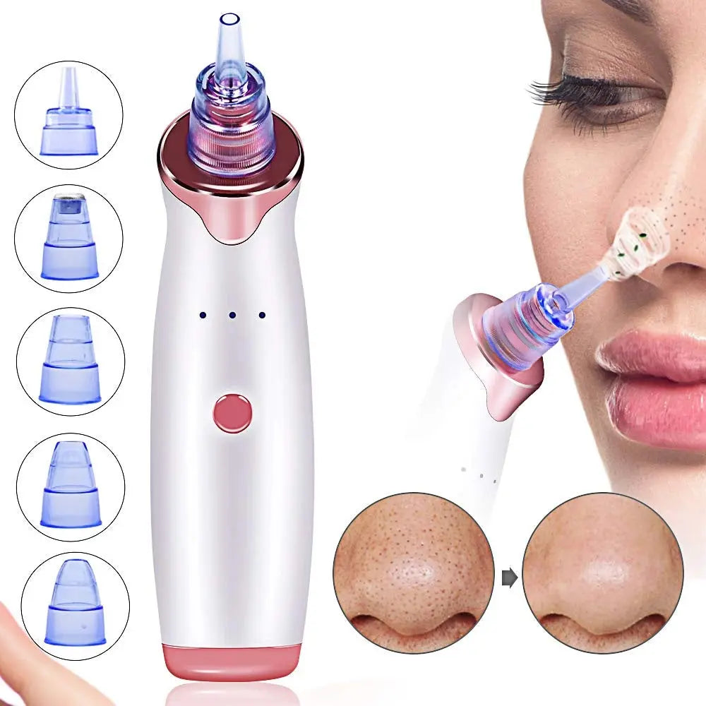 Electric Blackhead Remover Pore Vacuum Suction Diamond Dermabrasion Face Cleaner StreetSharks