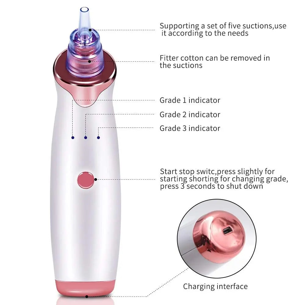 Electric Blackhead Remover Pore Vacuum Suction Diamond Dermabrasion Face Cleaner StreetSharks