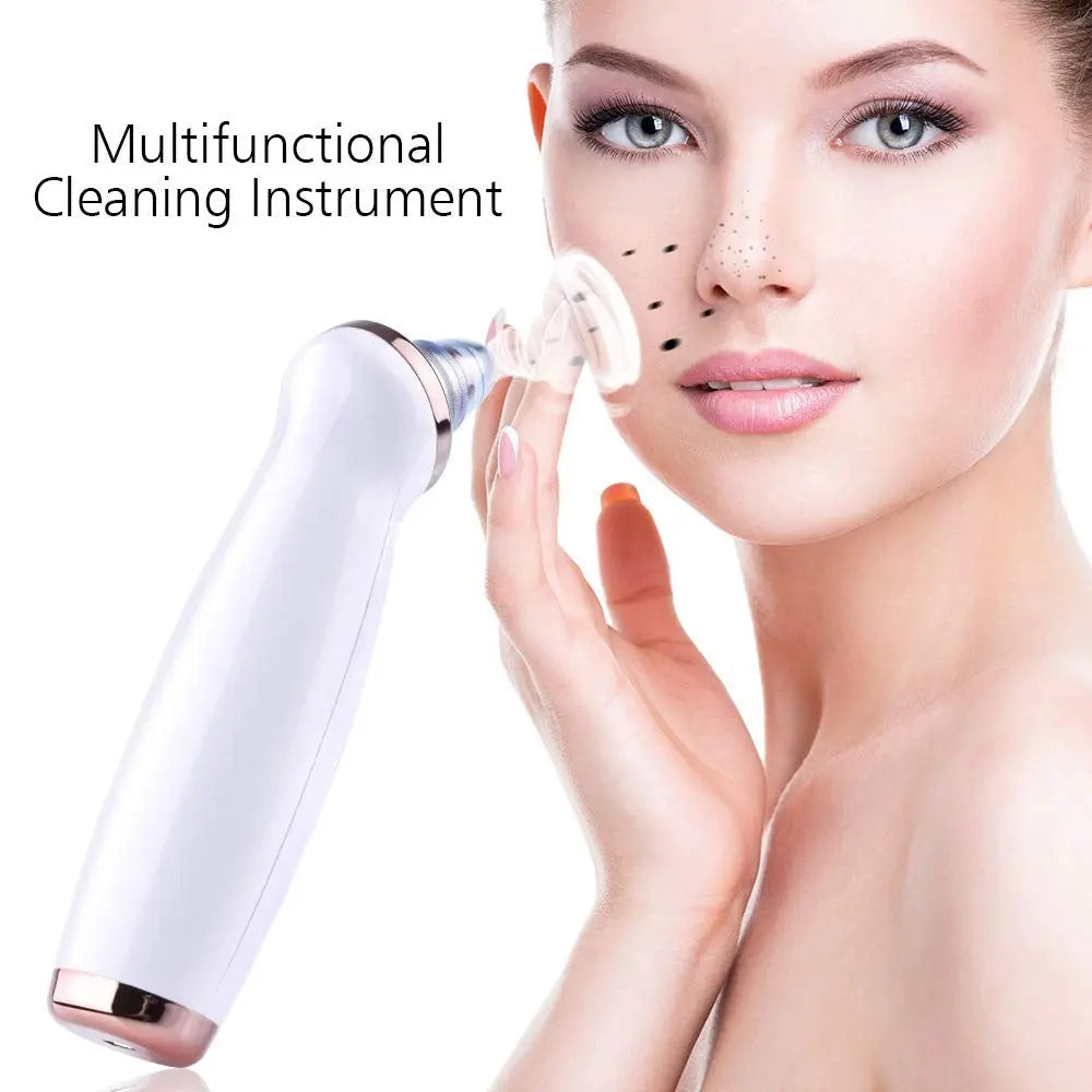 Electric Blackhead Remover Pore Vacuum Suction Diamond Dermabrasion Face Cleaner StreetSharks