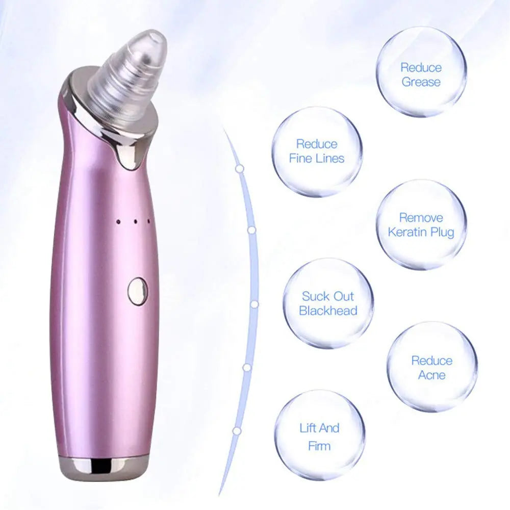 Electric Blackhead Remover Pore Vacuum Suction Diamond Dermabrasion Face Cleaner StreetSharks