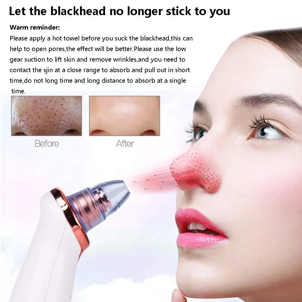 Electric Blackhead Remover Pore Vacuum Suction Diamond Dermabrasion Face Cleaner StreetSharks