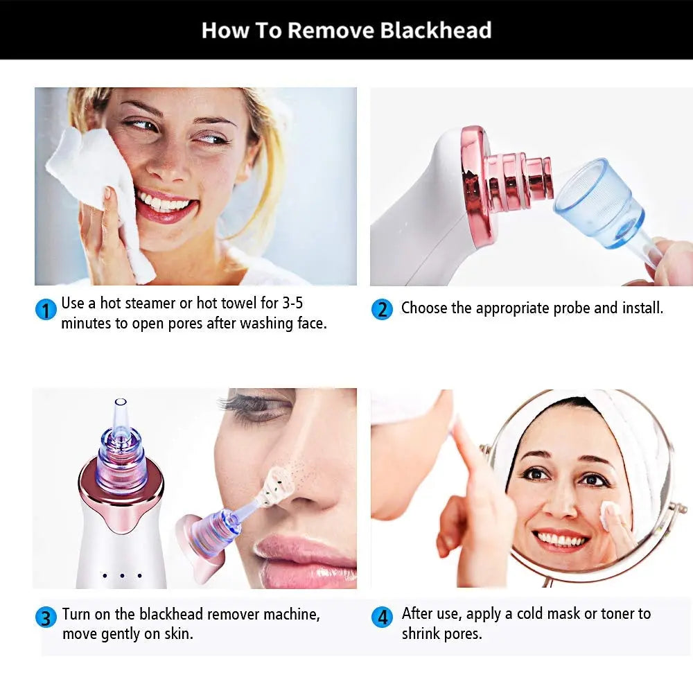 Electric Blackhead Remover Pore Vacuum Suction Diamond Dermabrasion Face Cleaner StreetSharks